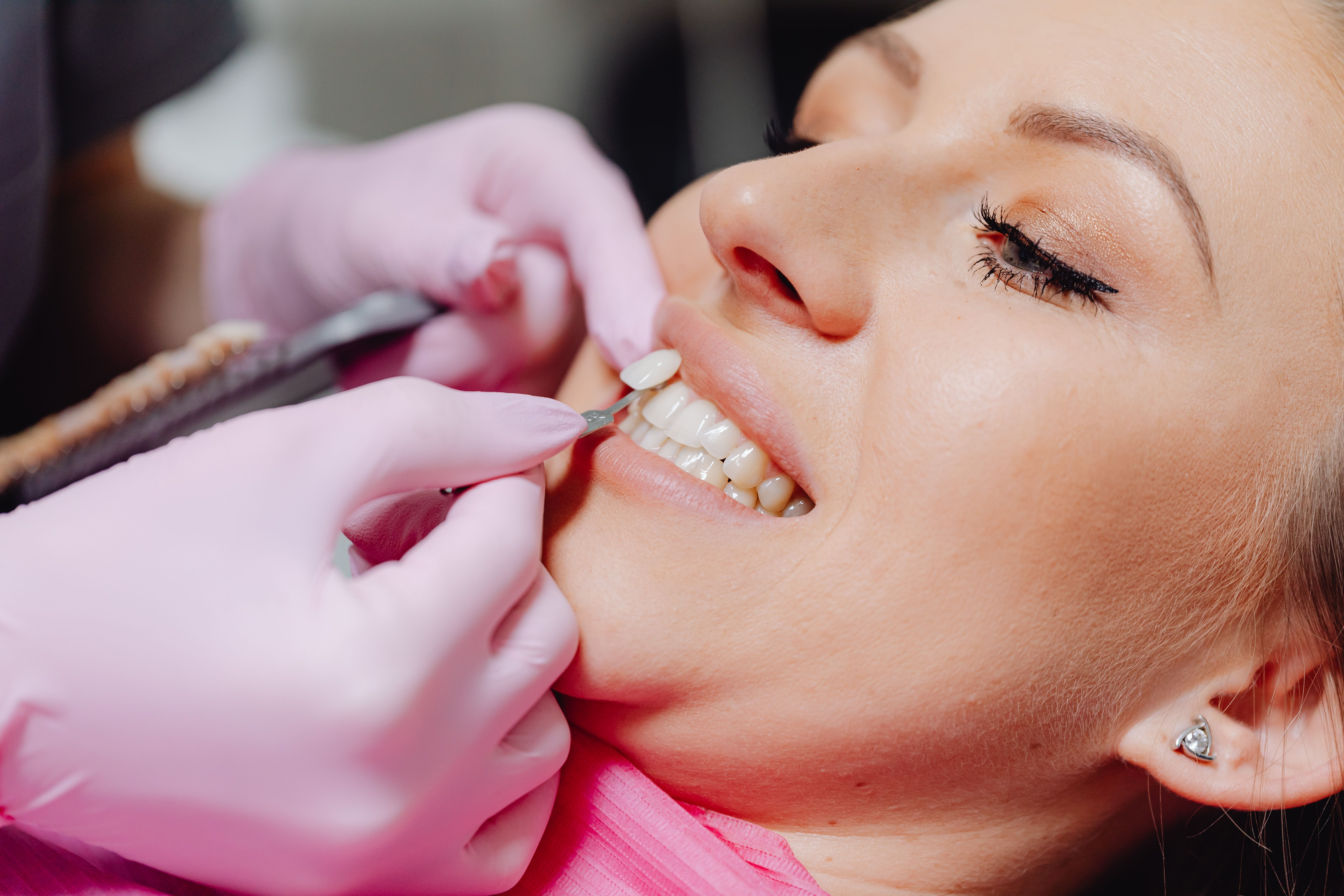 Dental implant restoration process